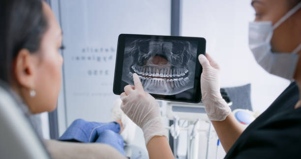 Licensed Tooth Extraction service in Morro Bay, CA - Smile Center Dentistry